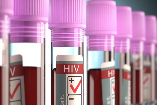 HIV - AIDS