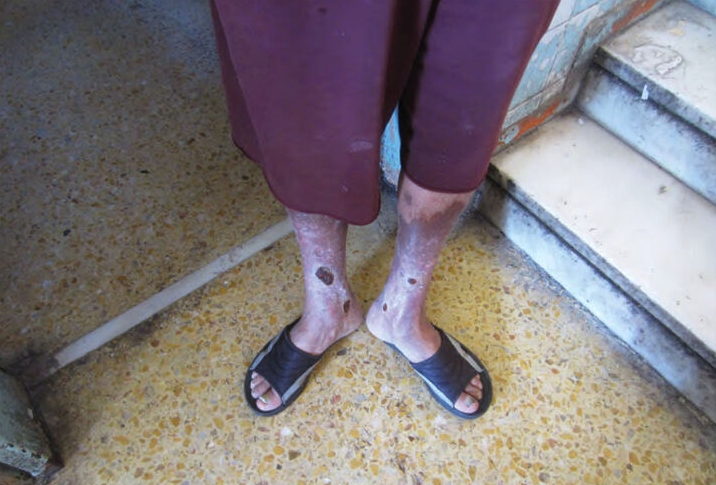 korydallos