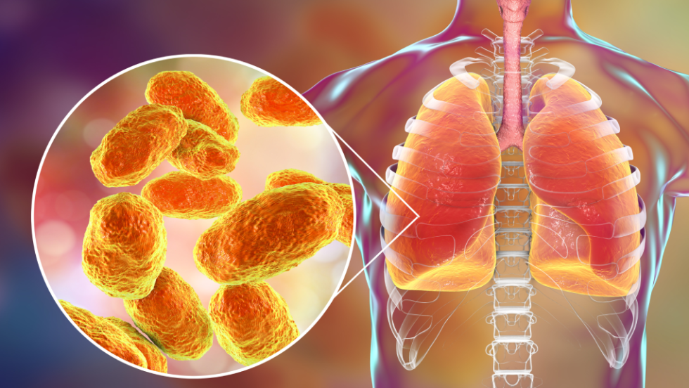 pneumonia