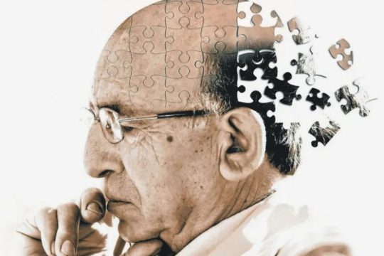 Alzheimer_1020