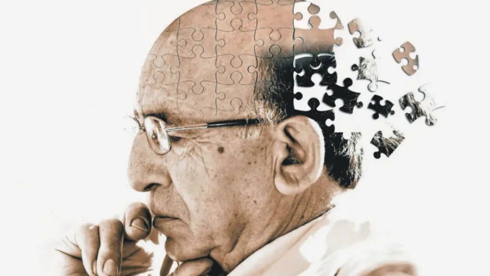 Alzheimer_1020