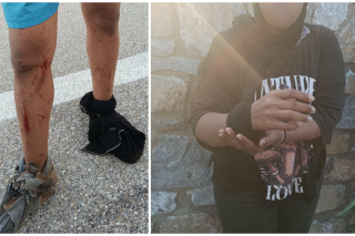 Φωτογραφίες με πρόσφυγες να επιδεικνύουν τα τραύματά τους έδωσε στη δημοσιότητα η Aegean Boat Report