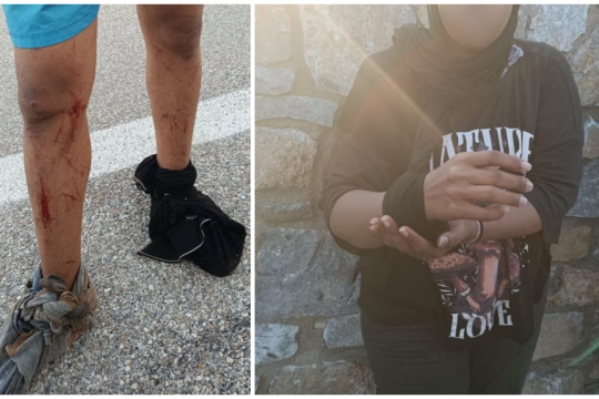Φωτογραφίες με πρόσφυγες να επιδεικνύουν τα τραύματά τους έδωσε στη δημοσιότητα η Aegean Boat Report