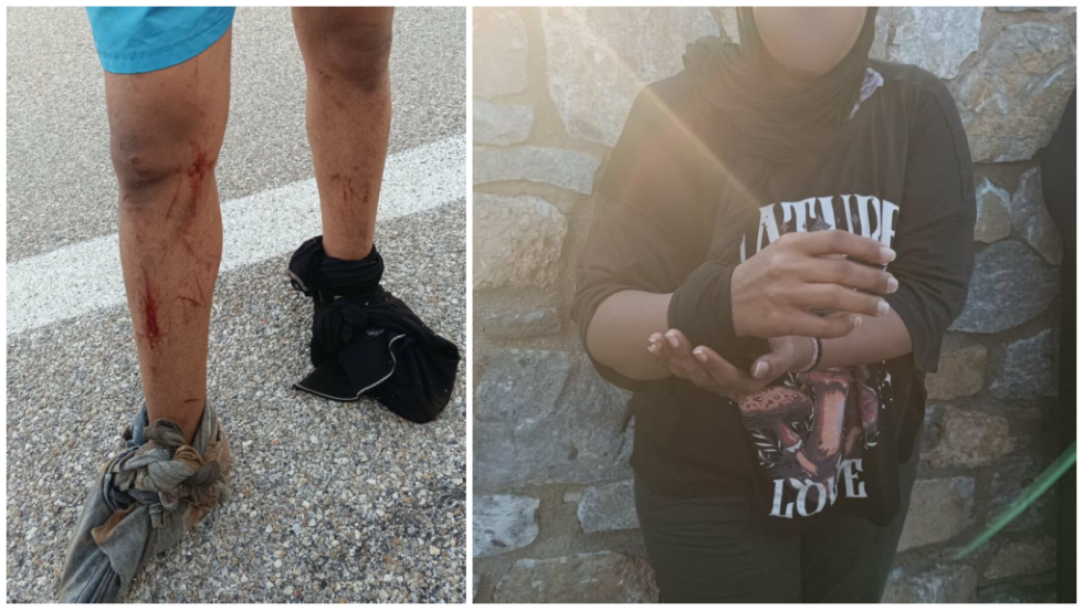 Φωτογραφίες με πρόσφυγες να επιδεικνύουν τα τραύματά τους έδωσε στη δημοσιότητα η Aegean Boat Report