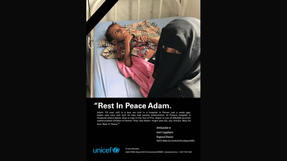 Αφίσα της UNICEF για τα παιδιά που πεθαίνουν από ασιτία στην Υεμένη