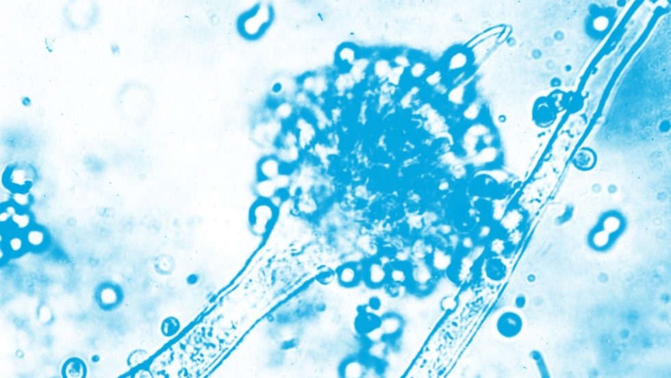 Plague_1020