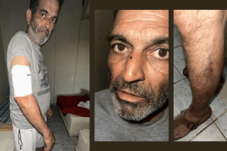 Με επιδέσμους και εμφανή τραύματα στα σημεία που χτυπήθηκε από τον σιδερένιο σωλήνα που χρησιμοποίησε ο «φίλος» του εργοδότη, ο Πακιστανός εργάτης που... έκανε το λάθος να ζητήσει τα δεδουλευμένα του