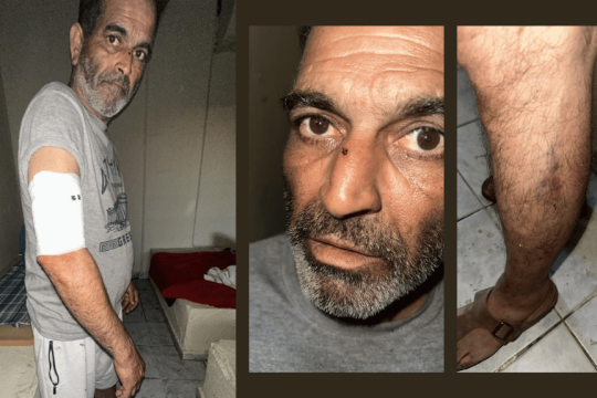 Με επιδέσμους και εμφανή τραύματα στα σημεία που χτυπήθηκε από τον σιδερένιο σωλήνα που χρησιμοποίησε ο «φίλος» του εργοδότη, ο Πακιστανός εργάτης που... έκανε το λάθος να ζητήσει τα δεδουλευμένα του