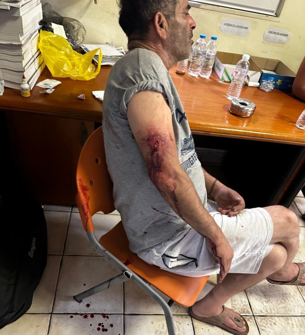 Αιμόφυρτος στο Α.Τ. λίγο μετά τον ξυλοδαρμό του