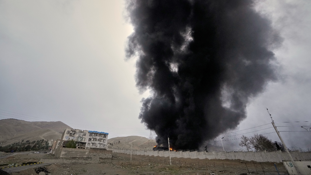 AP Photo
