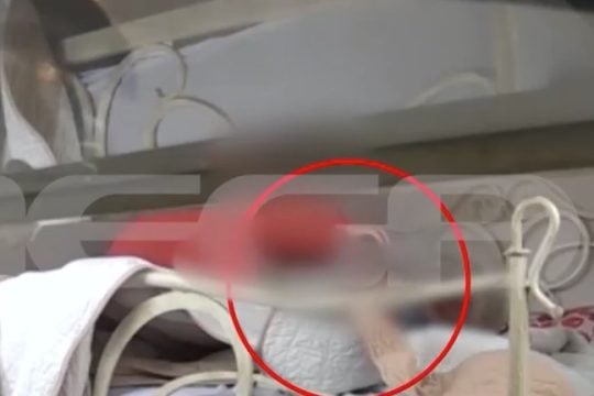 Χίος: Άγρια κακοποίηση 82χρονης από οικιακή βοηθό - «Μην με χτυπάς, δεν έκανα τίποτα» [βίντεο]