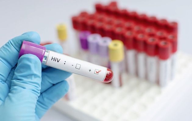 Ο ρετροϊός HIV & η μάστιγα του AIDS