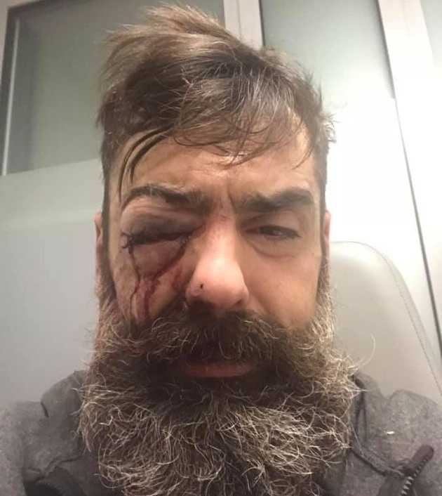 «Κόκκινα φουλάρια», η απάντηση στα «κίτρινα γιλέκα»