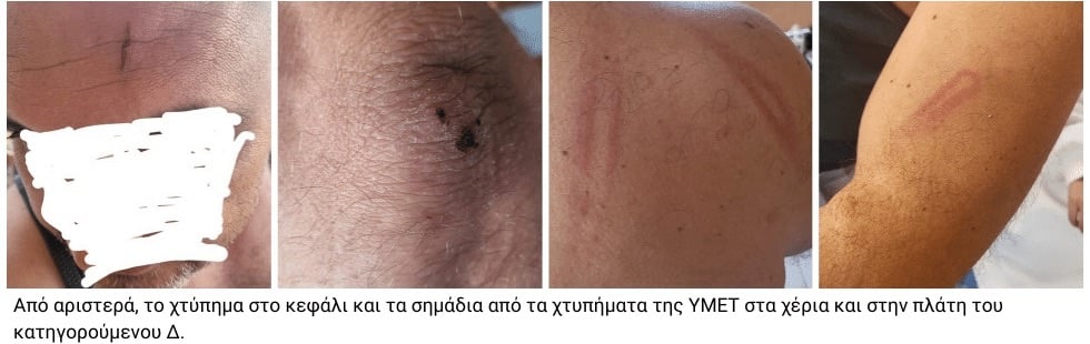 Ακραία αστυνομική βία με θύμα πατέρα δύο παιδιών