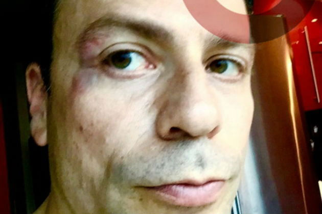 Κέρδος η ανατροπή