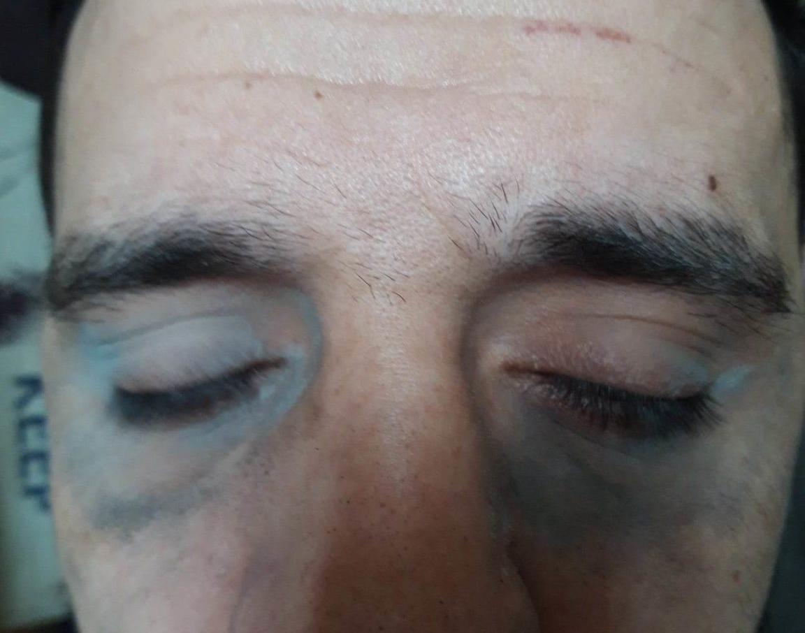 Απόπειρα εκδικητικής αλλαγής πτέρυγας κρατουμένου μετά από βασανισμό του