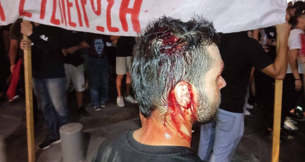 Ούτε με ξύλο ούτε με χημικά καταστέλλεται ο φοιτητικός αγώνας