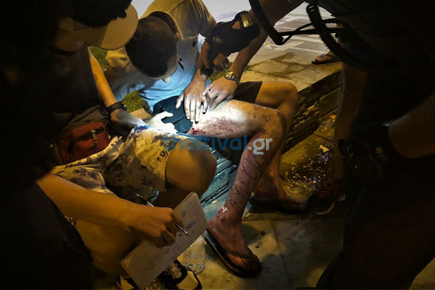 Ρατσιστική επίθεση σε μετανάστες με μαχαίρι