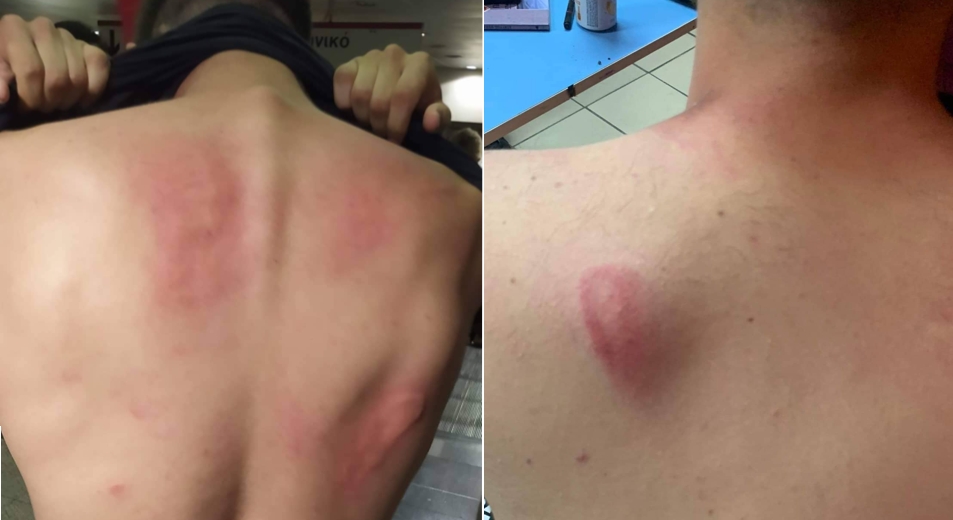 Ούτε με ξύλο ούτε με χημικά καταστέλλεται ο φοιτητικός αγώνας