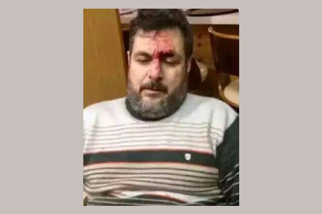 Άγριος ξυλοδαρμός οπαδού της ΑΕΚ