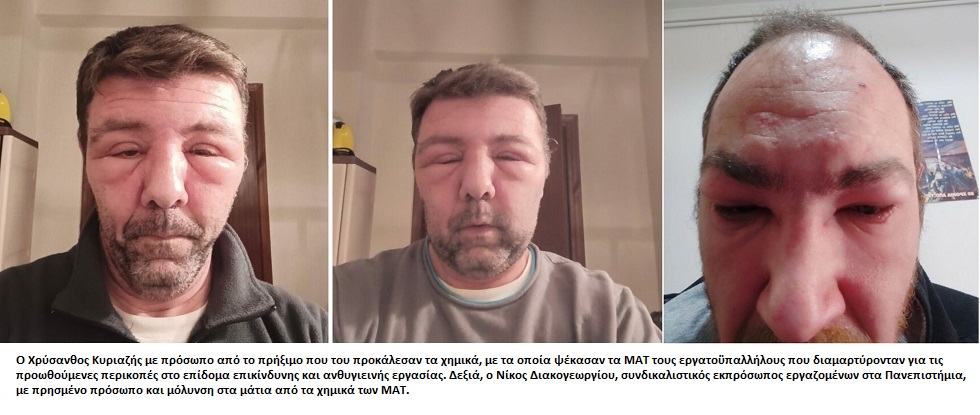 Κινδύνευσε η ζωή τους από τα χημικά των ΜΑΤ