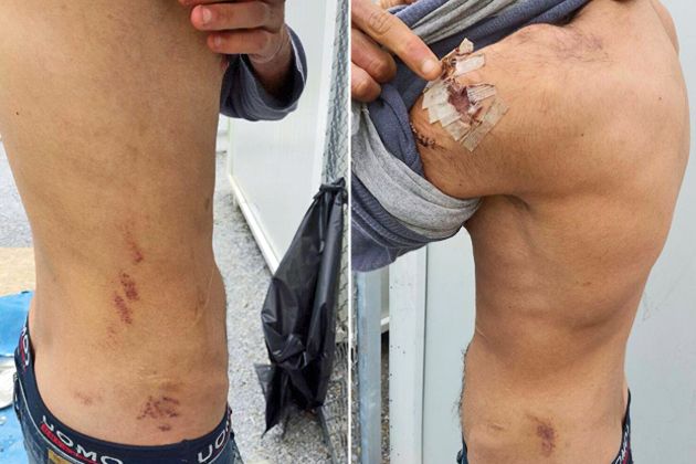 Πήγες να αυτοκτονήσεις; Συλλαμβάνεσαι και βασανίζεσαι