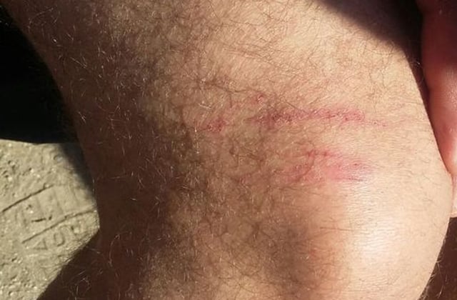 «Μας χτύπησαν, μας έριξαν στον γκρεμό και μας πυροβόλησαν!»